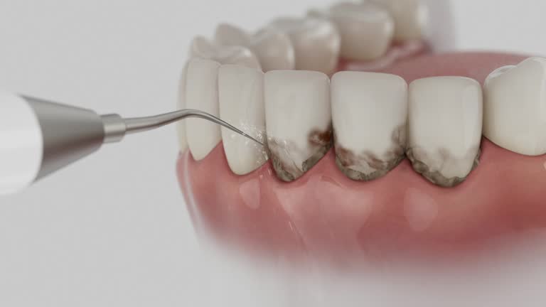 Reliable Dental contractor in Berry College, GA by Dentist Open Now
